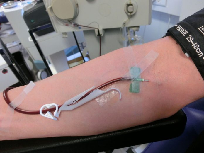 Blood_plasma_donation_3653